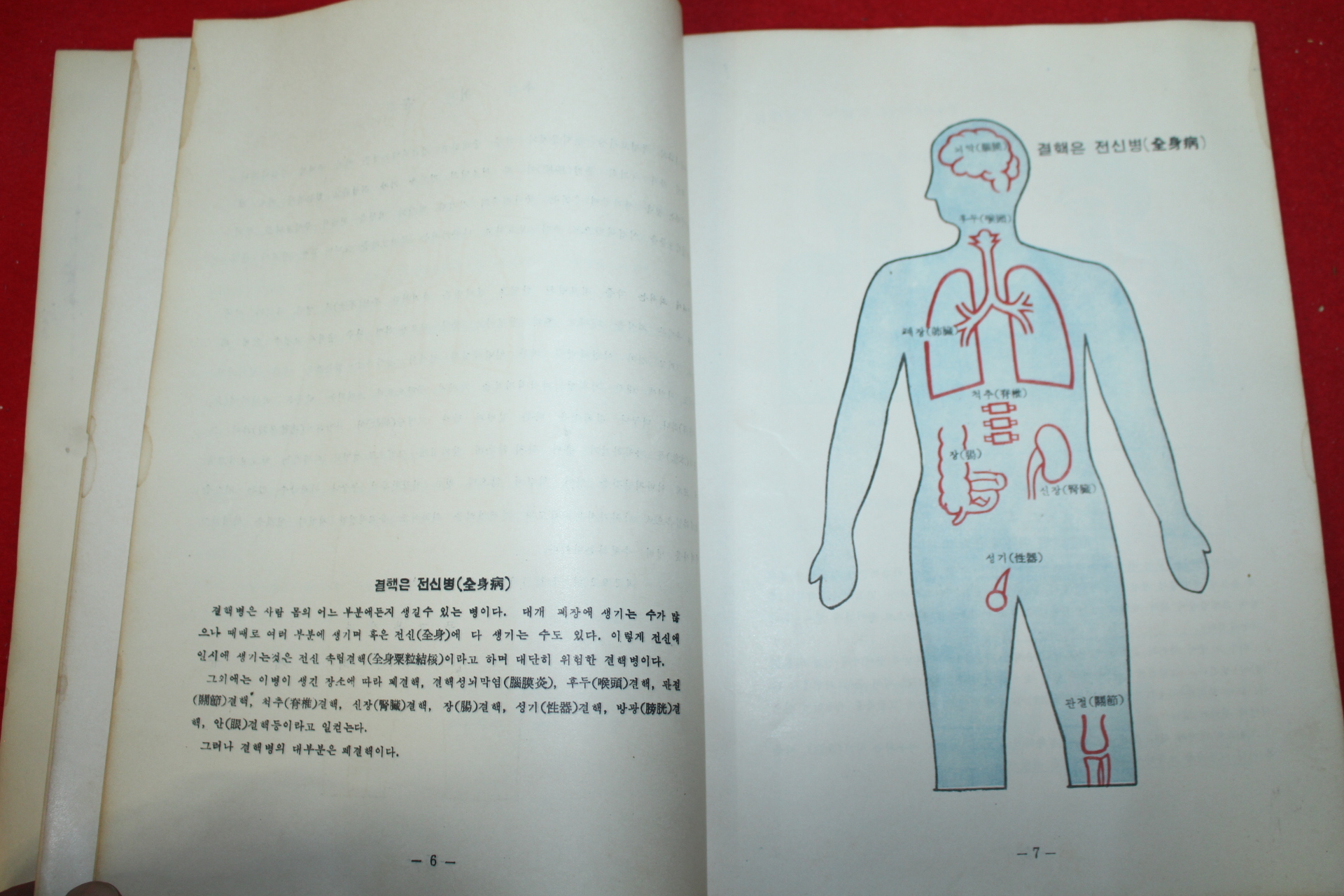 1959년 눈으로 보는 결핵의 과학